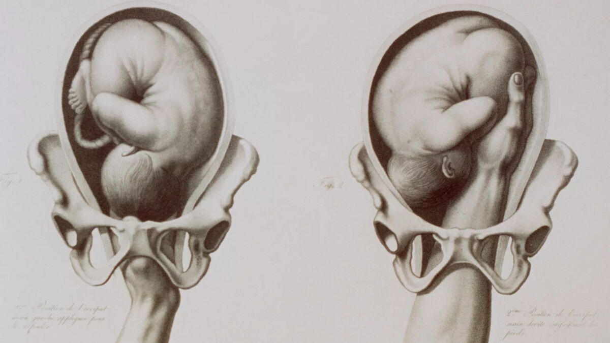 A foetus can get an erection at 16 weeks, here