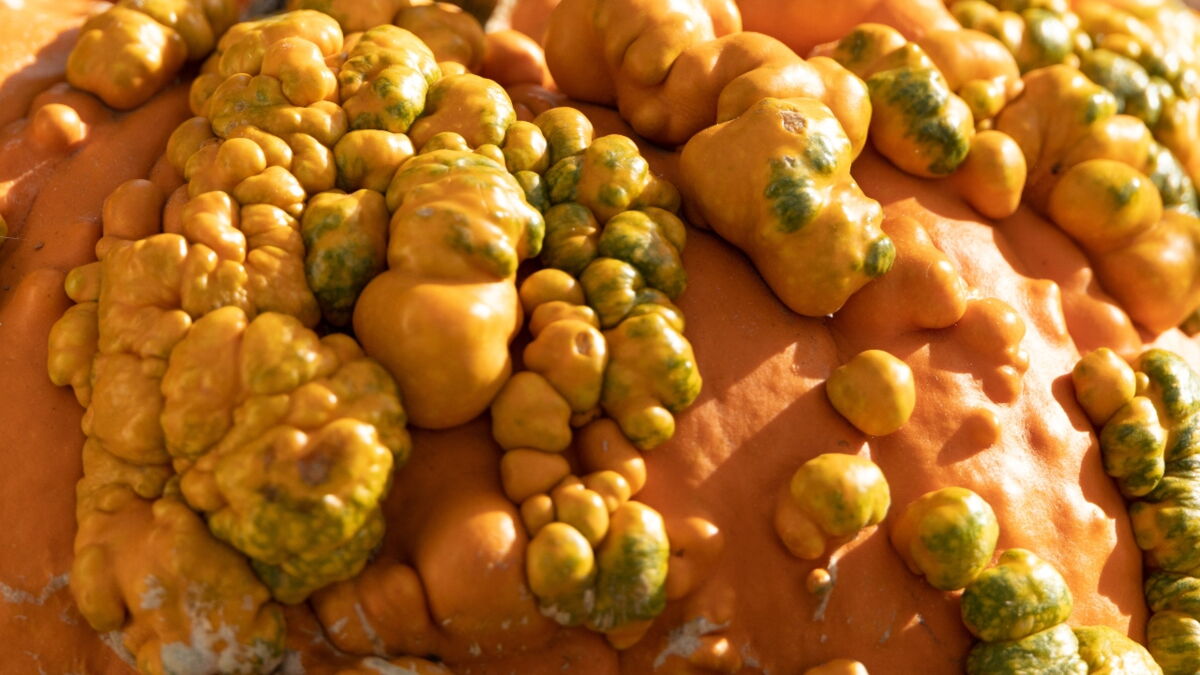 Genital warts Here's why you should be worried