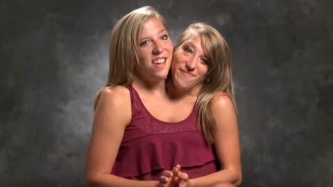 Abby and Brittany Hensel: Conjoined twins with very different personalities