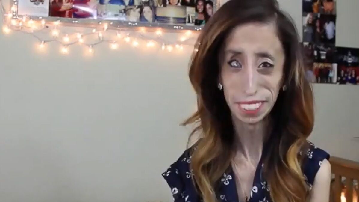 Lizzie Velasquez : La femme la plus laide du monde lance un appel pour  faire cesser les moqueries