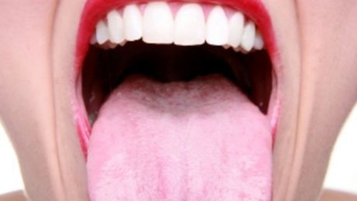 Sa langue reste collée à un lampadaire