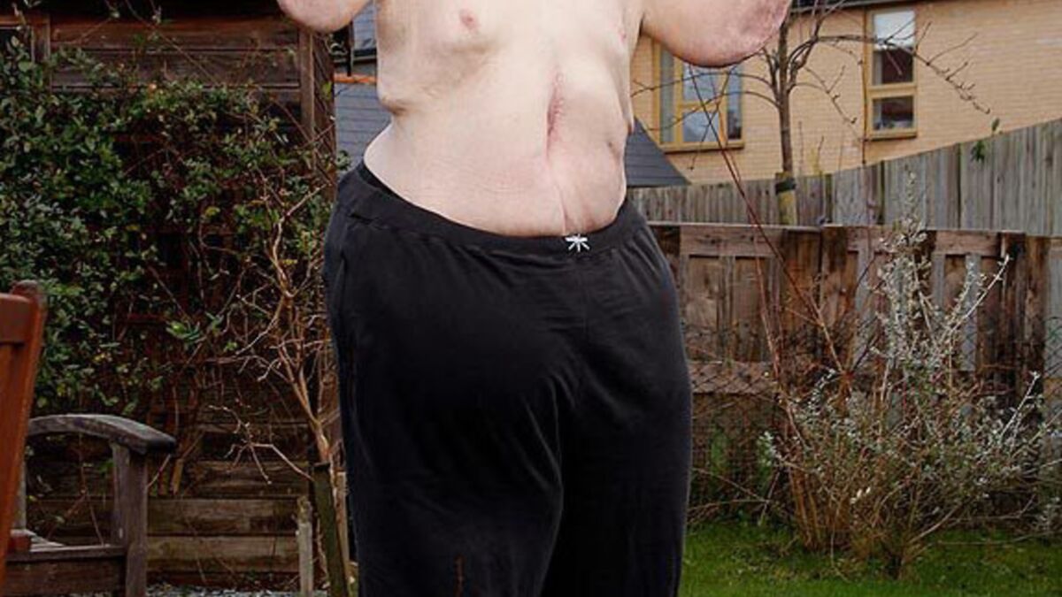 Le Plus Gros Rot Du Monde L'homme le plus gros du monde a perdu près de 300 kilos !