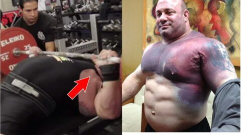 Scott Mendelson reißt sich beim Bankdrücken einen Brustmuskel