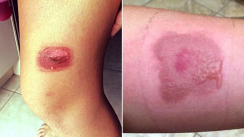 Die „Salt and Ice Challenge“: Die neueste Verrücktheit der sozialen Netzwerke könnte dich teuer zu stehen kommen