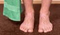 Familienvater bekommt Panik, als er bemerkt, dass sein Fuß plötzlich ganz schwarz ist