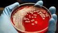 Forscher finden heraus: Dieses Bakterium hat es auf menschliches Blut abgesehen