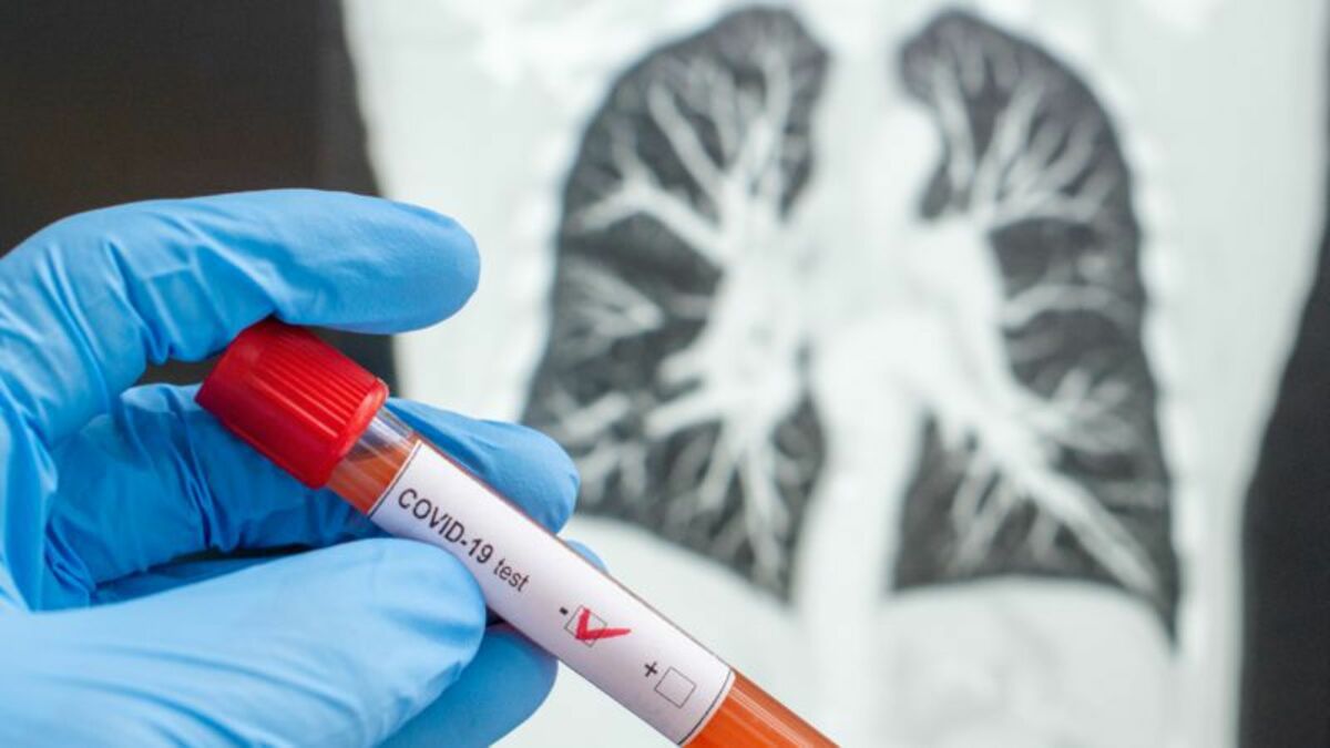 Ab Wann Sind Ringelröteln Nicht Mehr Ansteckend Covid-19: Ab welchem Zeitpunkt ist ein Patient nicht mehr ansteckend?