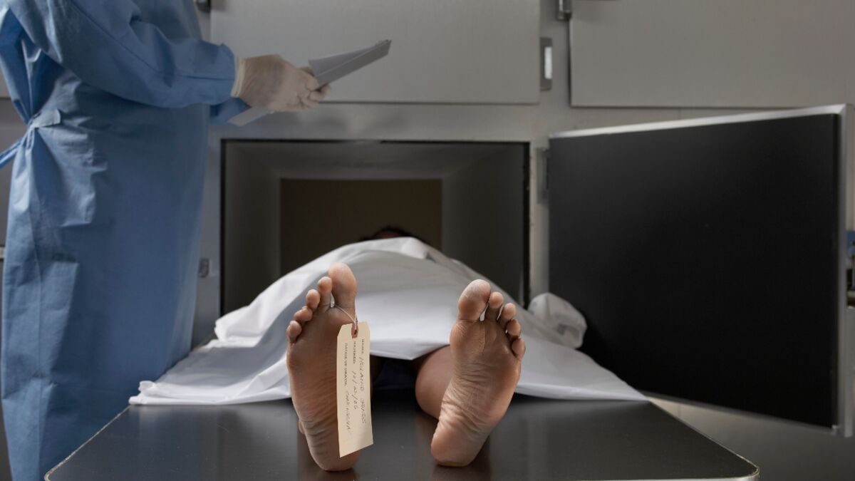 In Welcher Reihenfolge Löst Sich Die Totenstarre Die Leichenstarre (Rigor mortis): Der Vorgang, der kurz nach dem
