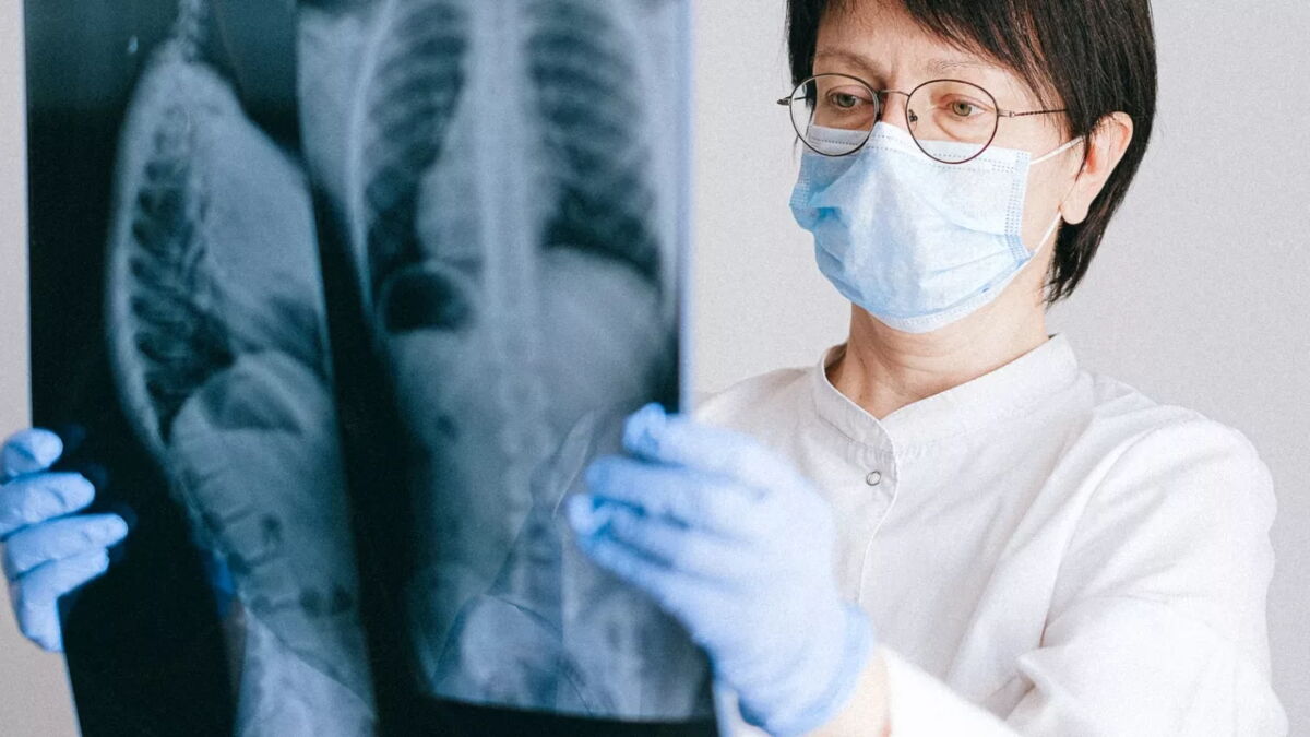 Lungenkrebs erkennen mit einfachem Finger-Test