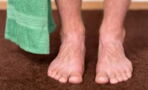 Familienvater bekommt Panik, als er bemerkt, dass sein Fuß plötzlich ganz schwarz ist