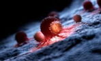 Krebsforschung: Botenstoff entdeckt, der Metastasenbildung hemmt