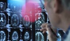 Alzheimer Sorge? Die Überraschende Verbindung: Ist Lithiummangel Der Zündfunke Für Alzheimer? - r9q540e