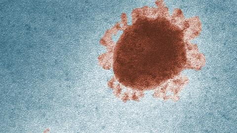 Neue "Variante von Interesse": WHO setzt "Mu" auf die Liste