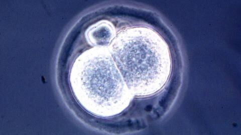 Durchbruch in Stammzellenforschung: Können wir aus Mäuseembryos menschliche Organe herstellen?