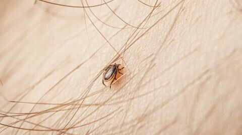 Infektion nach Zeckenbiss: Forscher entdecken neues Virus in China