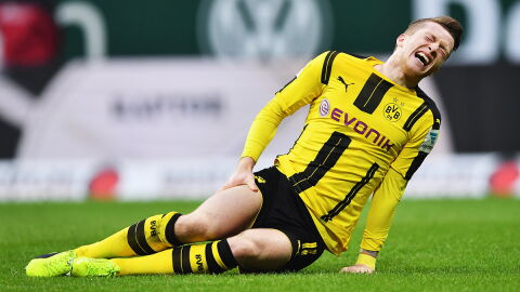 Marco Reus fiel schon oft aus, trotzdem führt er die Liste der am häufigsten verletzen Spieler nicht an.