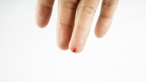 Bei nur einem Blutstropfen: Darum wird vielen Menschen ganz anders, wenn sie Blut sehen