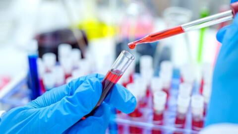 Botschaft der Hoffnung: Die Heilung eines zweiten HIV Patienten klingt wie ein Wunder