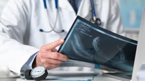 Körperteile, die sich zurückbilden