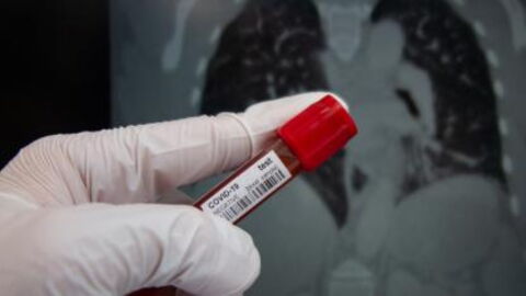 Corona-Studie: So schwer schädigt Covid-19 unsere Organe - und nicht nur die Lunge!