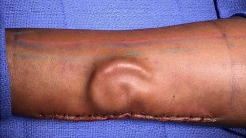 In dem Arm dieser Frau wächst ein anderes Körperteil!