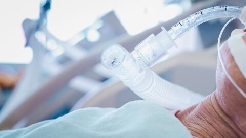 Parallelen zur Lungenfibrose: Studie erklärt, warum Covid-Patient:innen so lange beatmet werden müssen