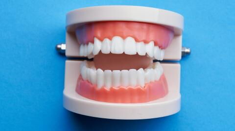 Zahn-Hygiene: Woher kommen die schwarzen Verfärbungen zwischen unseren Zähnen?