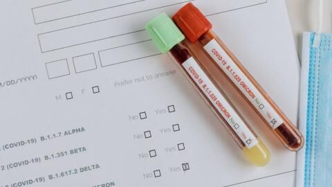 Ernüchternde Ergebnisse: Südafrikanische Studie untersucht Antikörperreaktionen auf Omikron