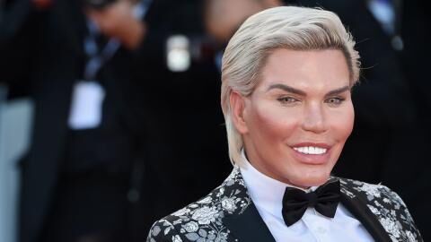Rodrigo Alves: So sah der „menschliche Ken“ früher aus