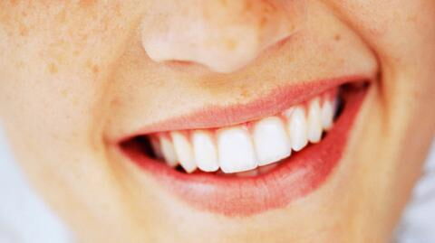 Frau geht zum Zahnarzt: Schlechte Angewohnheit führte zu Ausfall ihrer Zähne