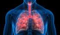 Ein neues "Körperteil" wurde in unserer Lunge entdeckt