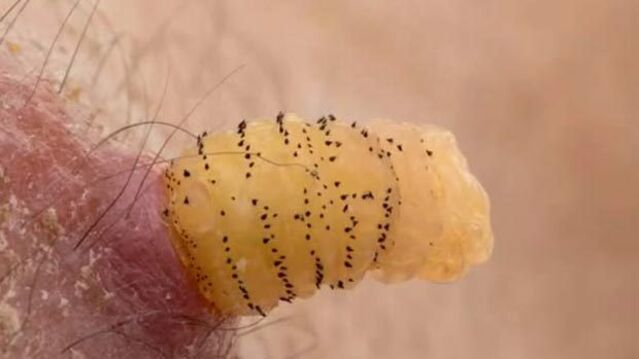 Un chercheur laisse grandir des larves de mouche dans son bras