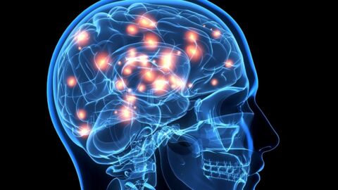 Bientôt un implant cérébral pour améliorer la mémoire ?
