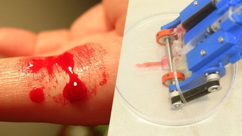 Des chercheurs créent un dispositif capable d'imprimer de la peau pour soigner les blessures profondes