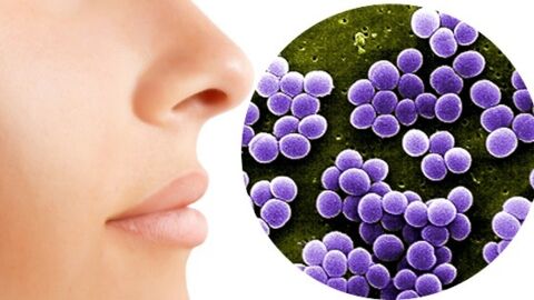 Un antibiotique efficace contre les bactéries résistantes identifié dans le nez humain