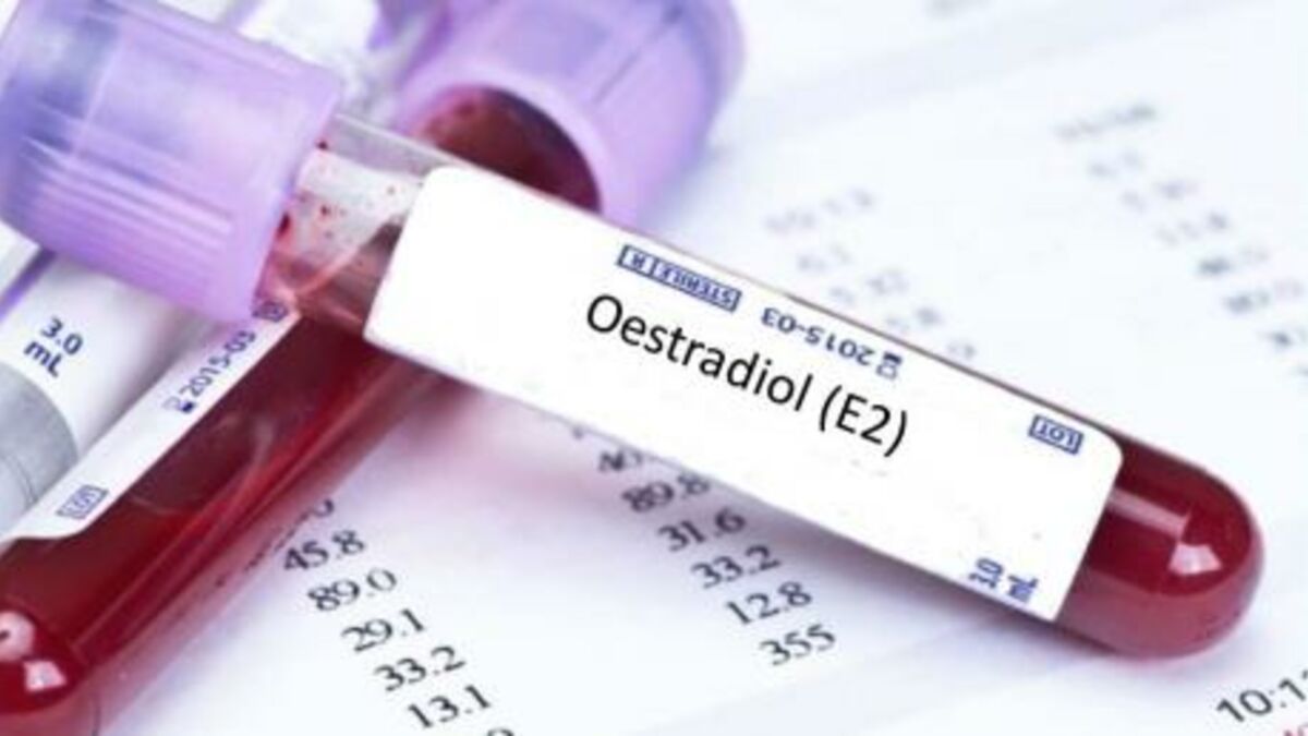 Oestradiol : définition, rôle, taux bas ou élevé, comment analyser les  résultats ?