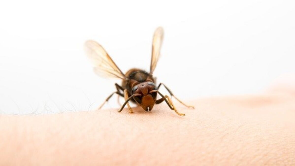 Piqûre d'abeille quelles sont les zones les plus douloureuses où se