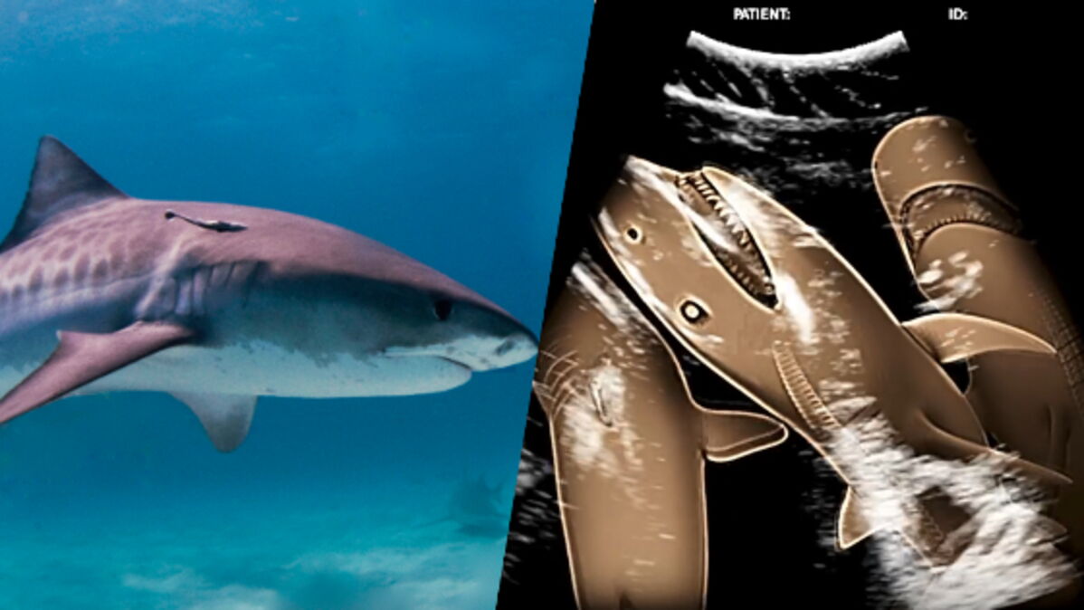 L’incroyable échographie d’une femelle requintigre enceinte