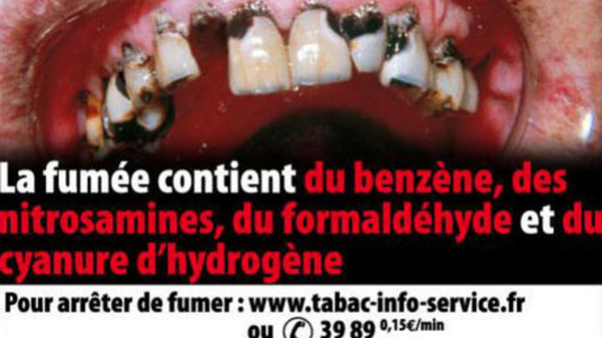 Les Images Choc Obligatoires Des Demain Sur Les Paquets De Cigarettes