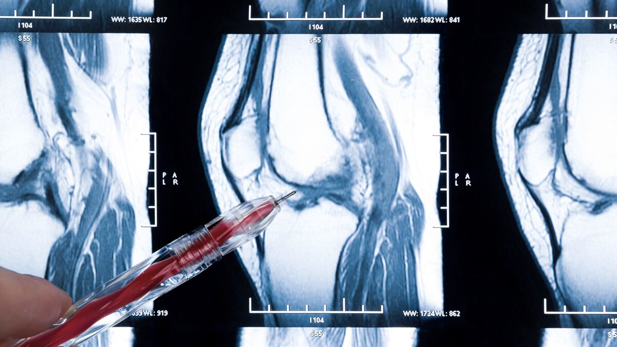 IRM du genou : définition, comment se passe un examen, et y a-t-il des  risques ?