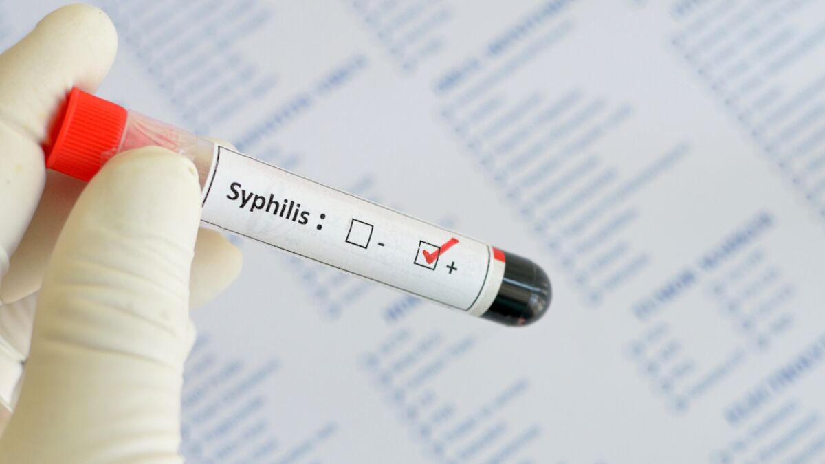 syphilis-d-finition-sympt-mes-traitement-de-quoi-s-agit-il