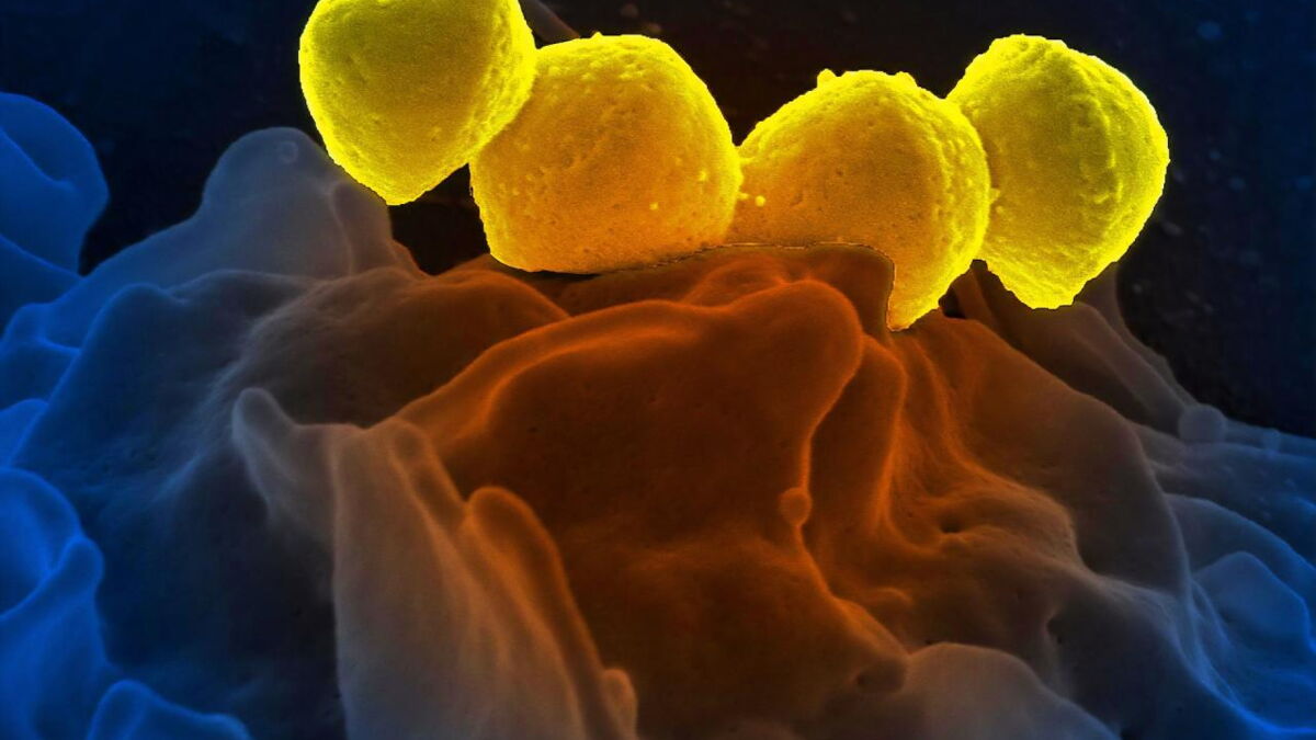 Streptocoque groupe A, groupe B, pneumocoque, de quoi s’agitil