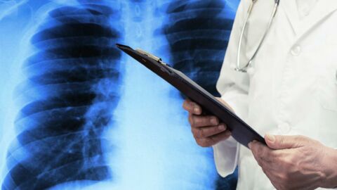 Pneumothorax : définition, symptômes, causes, traitement, de quoi s'agit-il ?