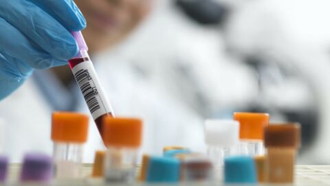 VIH : Pour la première fois, des chercheurs identifient où se cache le virus du Sida