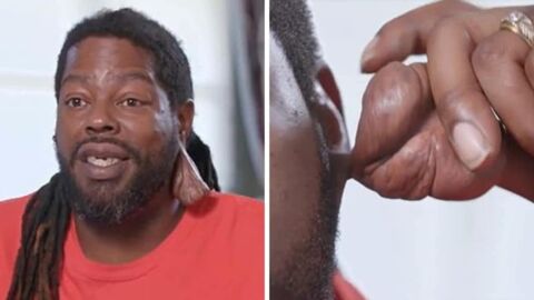 Maladie : un homme de 21 ans se fait retirer un "testicule" de son oreille