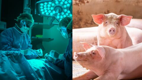 États-Unis : la première transplantation d'un rein de porc sur l'homme réussie