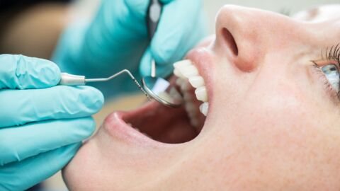 TikTok : des dentistes alertent sur une nouvelle pratique dangereuse