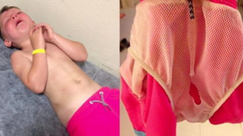 Mum Shares Warning To Parents After Her Son Suffers Painful Swimming Trunks Accident