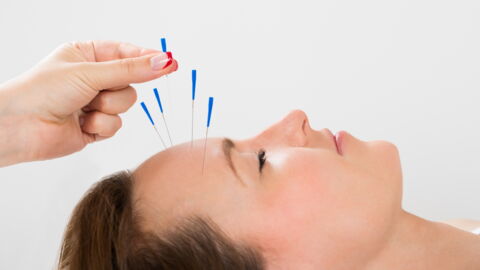 How To Use Acupuncture For Weight Loss