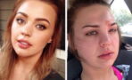 This Woman Almost Died Because She Didn't Wash Her Makeup Brushes